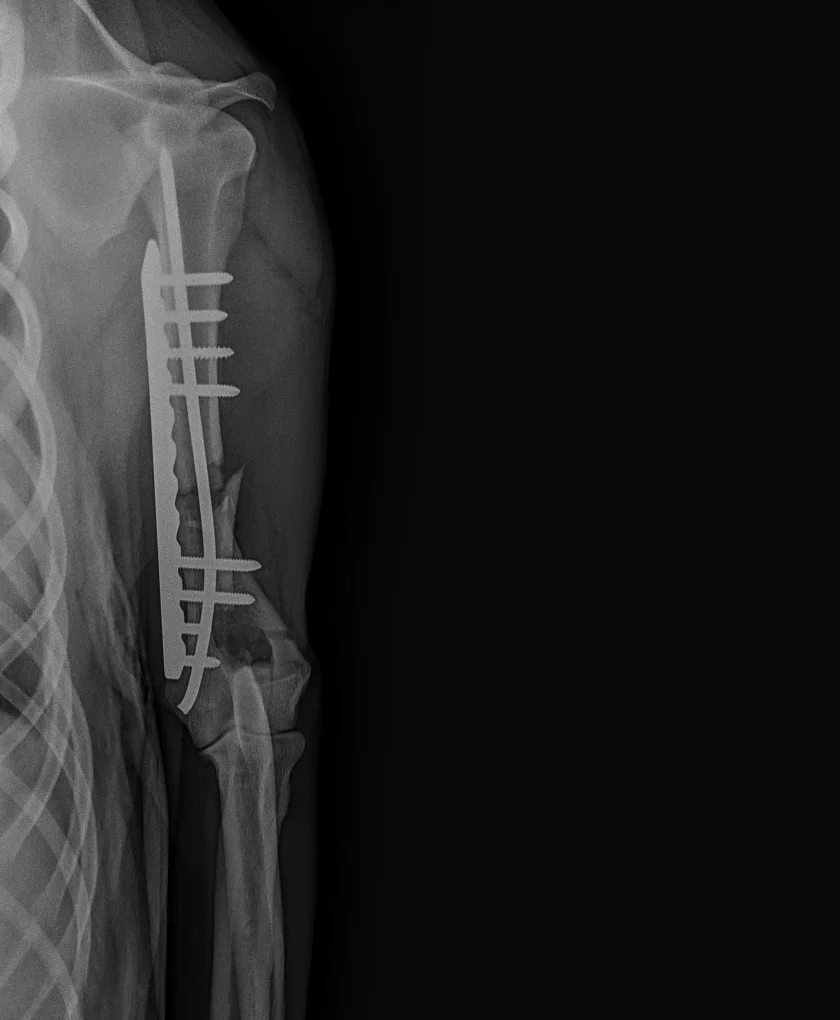 X-ray 1