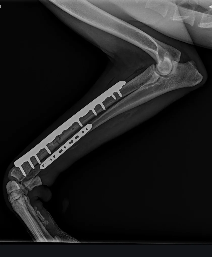 X-ray 2
